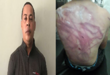 Photo of Montecristi PN apresa “in fraganti” padre flageló espalda a su hijo de once años con cable freno de bicicleta.