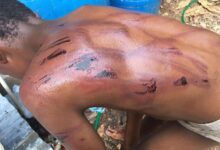 Photo of PN busca padre agredió severamente hijo menor en Montecristi.